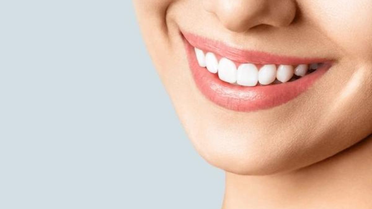 Healthy Smile