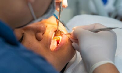 Oral Surgery