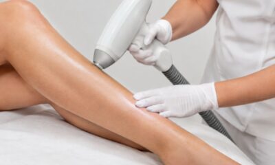 Laser Hair Removal